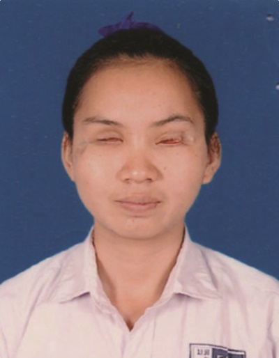 LA DALAVONG 
